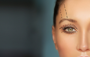 Central-Surgery Eyelid Surgery Adelaide